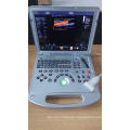 4D Funktion Laptop Farbe Doppler Ultraschallgerät Preis